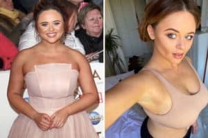 Emily Atack Before and After Weight Loss