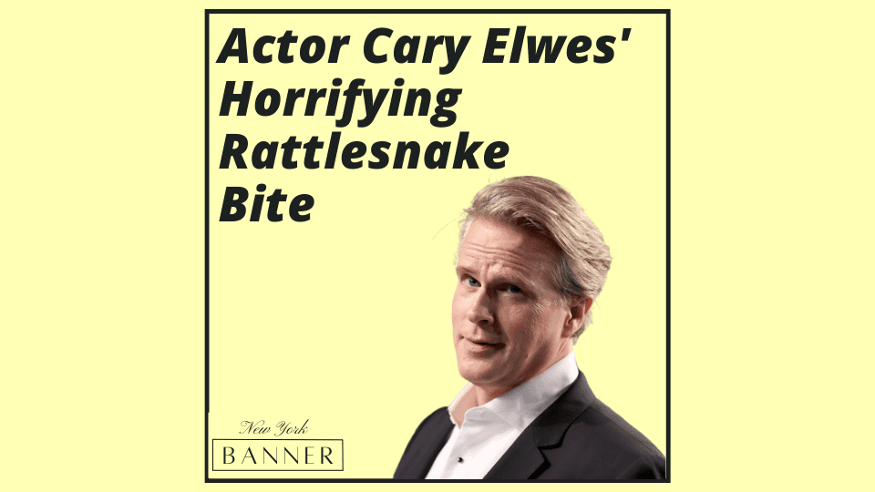 Actor Cary Elwes' Horrifying Rattlesnake Bite