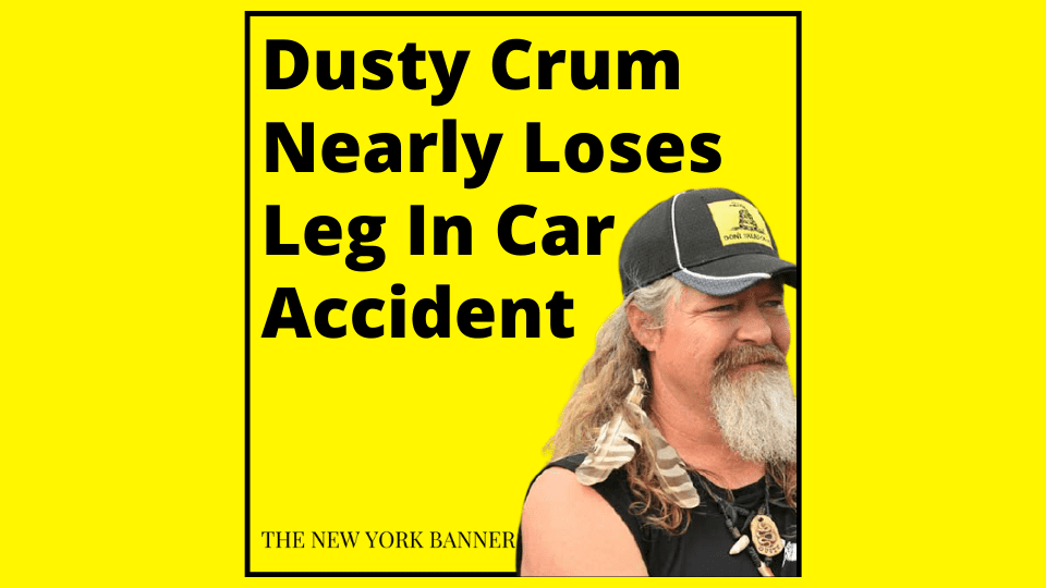 Dusty Crum Nearly Loses Leg In Car Accident