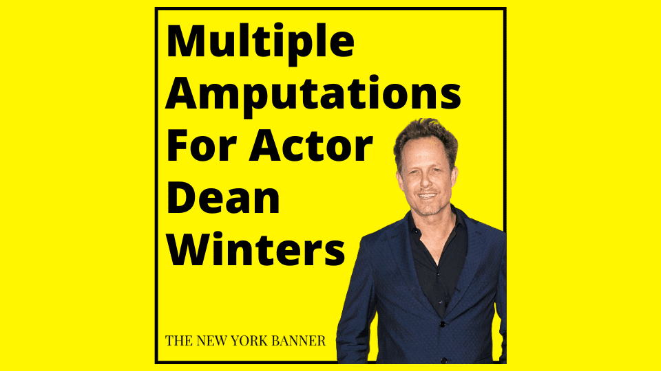 Multiple Amputations For Actor Dean Winters